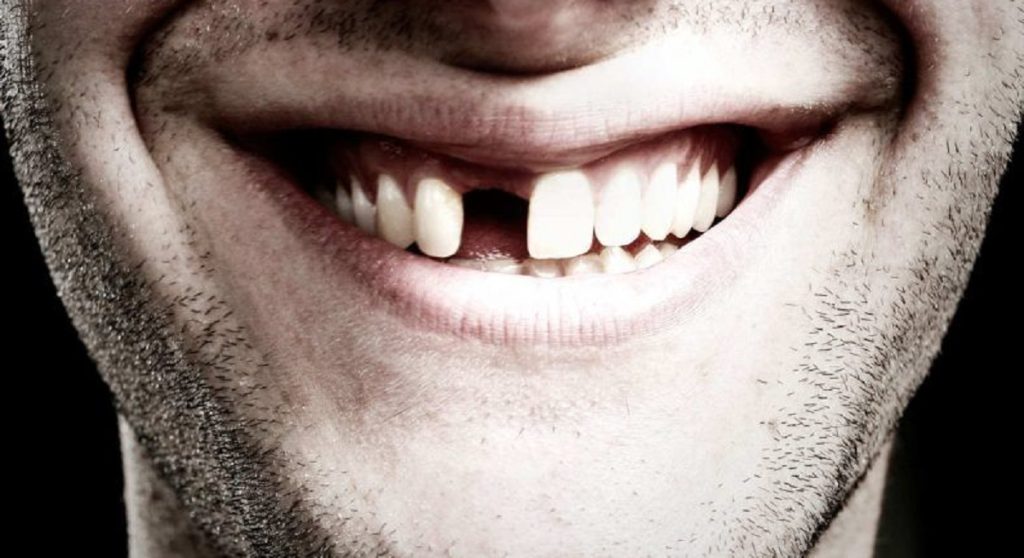 Was bedeutet es, wenn dir im Traum die Zähne ausfallen? Detaillierte Deutung unter psychologischen, kulturellen und spirituellen Aspekten