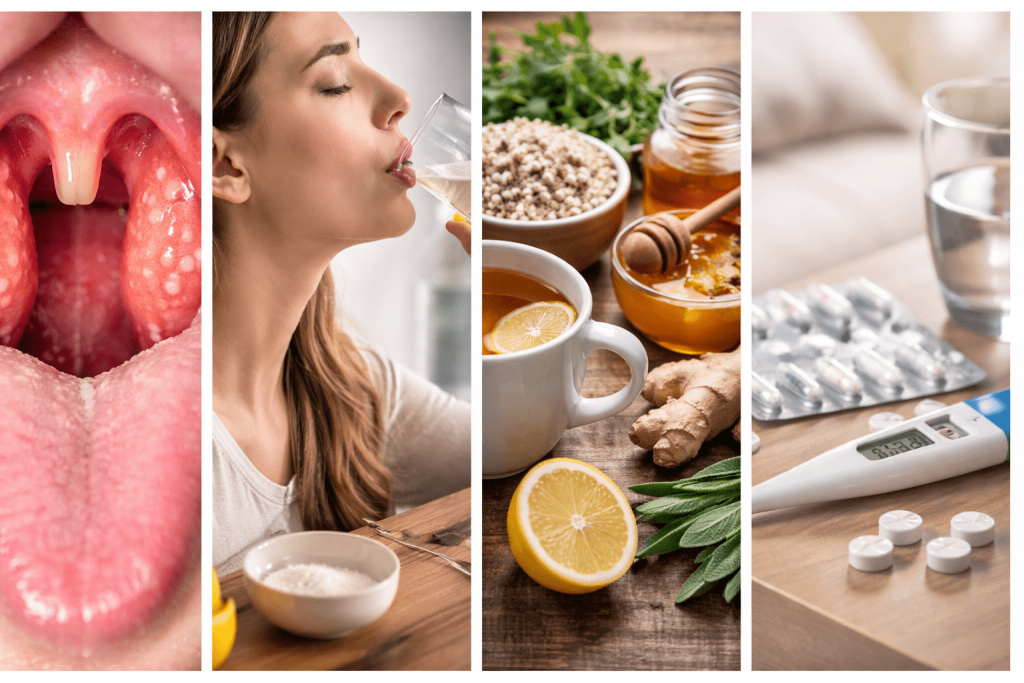 Angina zu Hause behandeln: wirksame Methoden, Risiken der Selbstbehandlung und klare Schritt-für-Schritt-Empfehlungen.