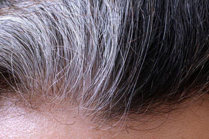 Frühes Ergrauen: Ursachen, Prävention und Regeneration