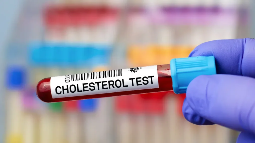 Hoher Cholesterinspiegel bleibt oft unbemerkt. So prüfen Sie LDL in Deutschland, erkennen Risiken und behandeln erhöhte Werte richtig.