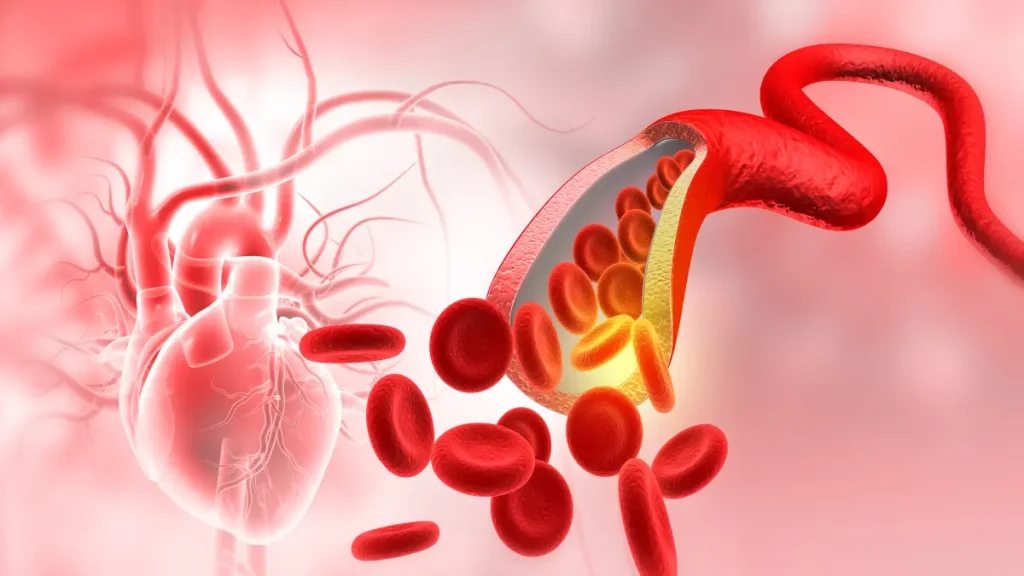 Evolocumab erhält erweiterte EU-Zulassung zur Senkung des Herzinfarktrisikos Evolocumab erhält 2026 eine erweiterte EU-Zulassung. Die VESALIUS-CV-Studie zeigt ein um 36 Prozent geringeres relatives Risiko für einen ersten Herzinfarkt.